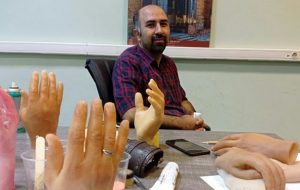 روایتی از ساخت انگشت هوشمند توسط یک نخبه تبریزی/ ایران در جمع ۵ کشور تولیدکننده دست الکترونیک روایتی از ساخت انگشت هوشمند توسط یک نخبه تبریزی/ ایران در جمع ۵ کشور تولیدکننده دست الکترونیک