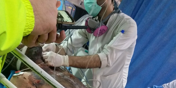 چهارشنبه سوری نیامده در آذربایجان تلفات داد/ آسیب چشمی نوجوان ۱۵ ساله شبستری، اولین مصدوم چهارشنبه سوری نیامده در آذربایجان تلفات داد/ آسیب چشمی نوجوان ۱۵ ساله شبستری، اولین مصدوم