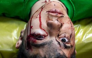 افزایش ۳۶ درصدی مصدومان چهارشنبه آخرسال در آذربایجان شرقی/ ۵۴ درصد مصدومان عابرین پیاده و تماشاگران بودند