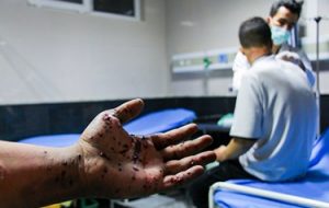 مصدومان چهارشنبه سوری ۱۴۰۱ در تبریز مصدومان چهارشنبه سوری ۱۴۰۱ در تبریز
