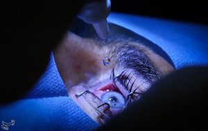 نجات محیط بان مجروح از نابینایی با عمل جراحی موفقیت آمیز