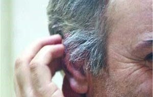 مصرف این سبزی ها می تواند ازسفید شدن موها جلوگیری کند